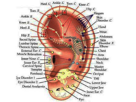 auriculartherapy Treatment